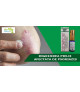 Afectiuni dermatologice